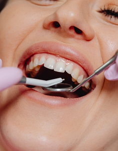 Dental 
